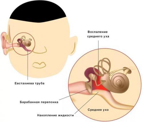 Что делать, если болит ухо: основные рекомендации и советы 05