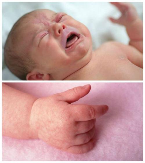 Влажный Кашель и температура 38 у ребенка. Кашель и температура у взрослого 03 Влажный Кашель и температура 38 у ребенка. Кашель и температура у взрослого 03