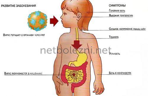 Ротавирусная инфекция на курортах. Способы заражения 06