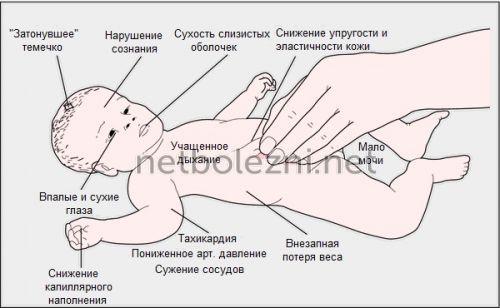 Ротавирусная инфекция на курортах. Способы заражения 08