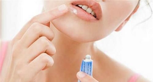 Мазь против простуды на губах. Помогает ли Виферон от герпеса 02 Мазь против простуды на губах. Помогает ли Виферон от герпеса 02