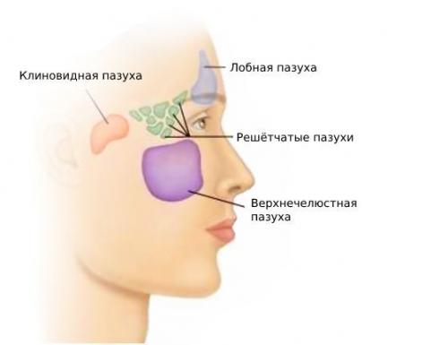 Острый гайморит код по мк.  Симптомы острого гайморита 01