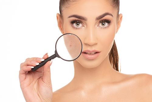 5 правил, как быстро избавиться от прыщей на лице. 06 5 правил, как быстро избавиться от прыщей на лице. 06