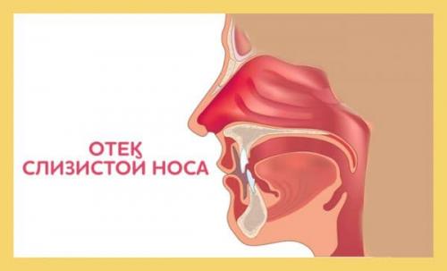 Как снять заложенность носа массажем. Точечный массаж при насморке и заложенности носа: упражнения в домашних условиях