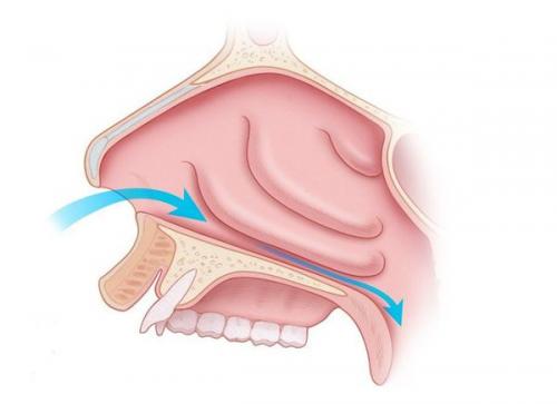 Заложенность носа и сильный насморк. Как вылечить насморк при ОРВИ в домашних условиях 5, 6 02 Заложенность носа и сильный насморк. Как вылечить насморк при ОРВИ в домашних условиях 5, 6 02