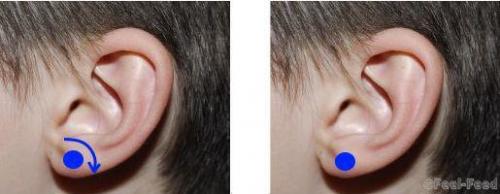 Как избавиться от насморка за 1 минуту. Как избавиться от насморка и заложенного носа за 1 минуту