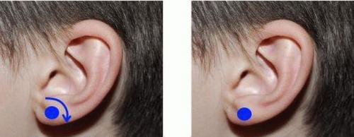 Как избавиться от насморка за 1 минуту. Как избавиться от насморка и заложенного носа за 1 минуту