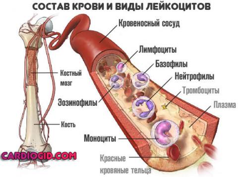 Как правильно интерпретировать результаты анализа крови при диагностике лейкоза. Методы исследования