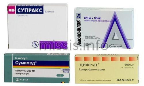 Средства от гриппа и орви. Рейтинг топ-10 недорогих и эффективных таблеток от простуды по версии КП 02