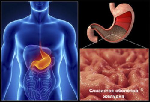 Как избавиться от скопления слизи в горле. Как избавиться от мокроты 02 Как избавиться от скопления слизи в горле. Как избавиться от мокроты 02
