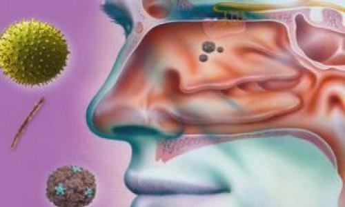 Как эффективно прочистить пазухи носа: проверенные способы 05