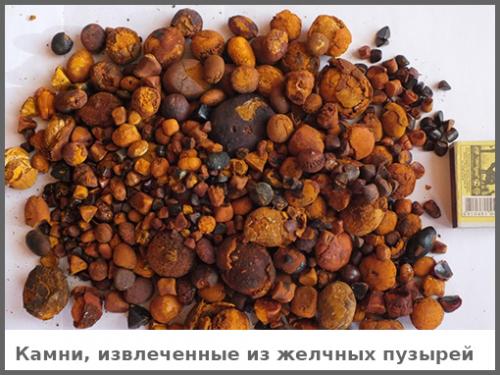 Почему болит правый бок. Причины боли в правом подреберье 02