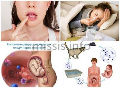 Признаки замершей беременности на ранних сроках. Общие сведения 04 Признаки замершей беременности на ранних сроках. Общие сведения 04