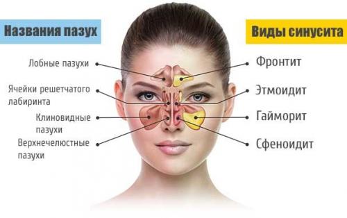 Бегут сопли, как вода, что делать. Сопутствующие симптомы