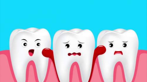 Восстановительный период после удаления зуба. Что делать после удаления зуба? 01