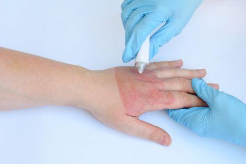 Чем лечить шишки от уколов на ягодицах. Симптомы и лечение при защемлении седалищного нерва 01