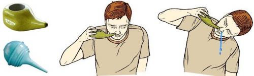 Признаки гайморита у детей 7 лет. Симптомы и признаки гайморита у детей 01 Признаки гайморита у детей 7 лет. Симптомы и признаки гайморита у детей 01