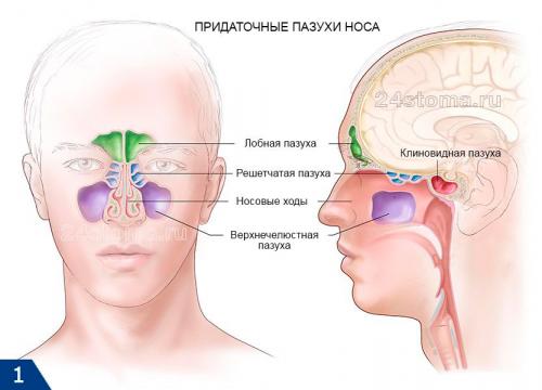 Гайморит и синусит лечение. Верхнечелюстной синусит: симптомы и лечение
