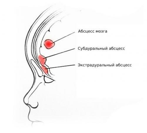 Связь лор-органов и глаз. Связь оториноларингологии с офтальмологией 04 Связь лор-органов и глаз. Связь оториноларингологии с офтальмологией 04