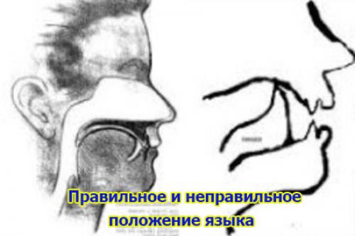 О взаимосвязи прикуса и расположения языка в ротовой полости. Положение языка в полости рта 01 О взаимосвязи прикуса и расположения языка в ротовой полости. Положение языка в полости рта 01