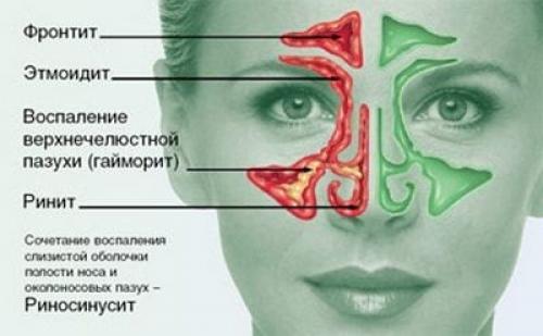 Когда нужно обращаться к отоларингологу. С какими симптомами обращаться к лору? 09 Когда нужно обращаться к отоларингологу. С какими симптомами обращаться к лору? 09