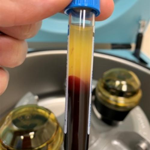 Антибиотики при бронхите для взрослых. Список топ-4 антибиотиков при бронхите по версии КП 07