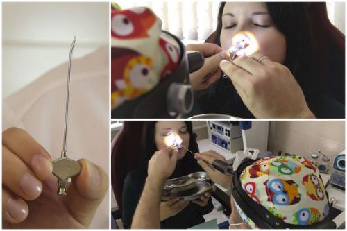 Как лечится острый синусит. Формы синусита 05 Как лечится острый синусит. Формы синусита 05