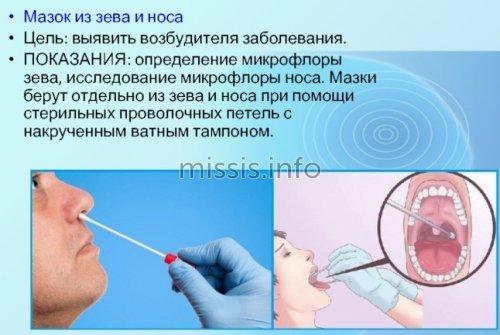 Эффективные антибиотики при гайморите для взрослых. Лечение антибиотиками: когда назначают и как пить 02