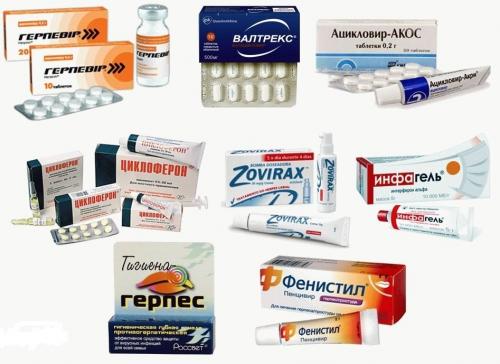 Простудные болячки на лице. Опоясывающий герпес на лице 03 Простудные болячки на лице. Опоясывающий герпес на лице 03