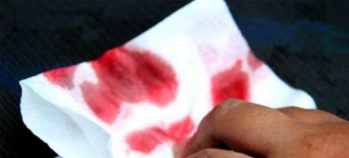 Важность гигиены во время менструаций: советы для женщин 07 Важность гигиены во время менструаций: советы для женщин 07