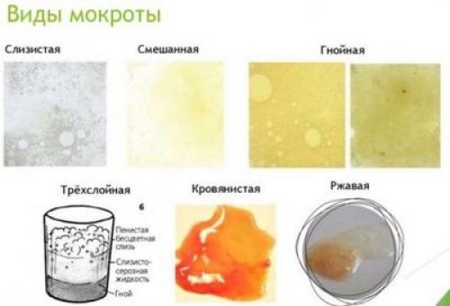 Желтые сопли у взрослых. Лечение желтых соплей у взрослых 01 Желтые сопли у взрослых. Лечение желтых соплей у взрослых 01